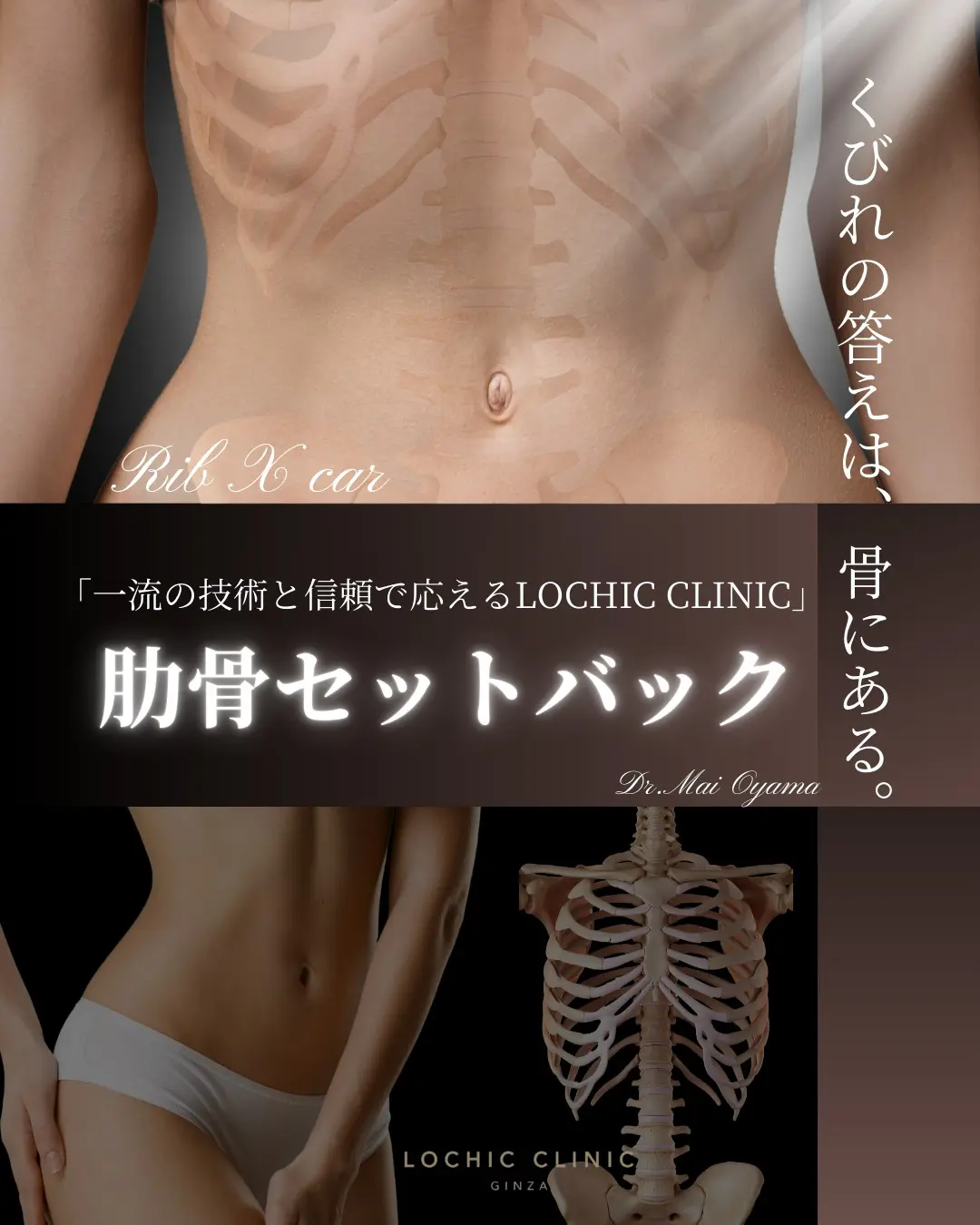 写真で見る　肋骨療法　エンタプライズ 肋骨骨折② | Radiation Journal｜医学部生や医療従事者のための画像 健康・医学