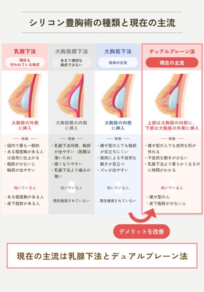 シリコン豊胸　シェーマ
