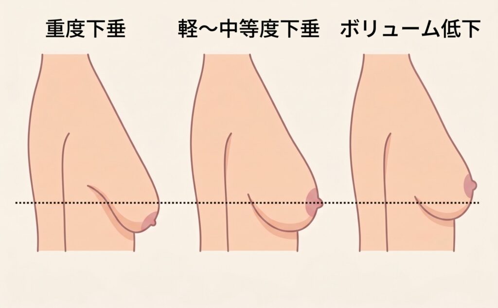 胸の垂れ具合