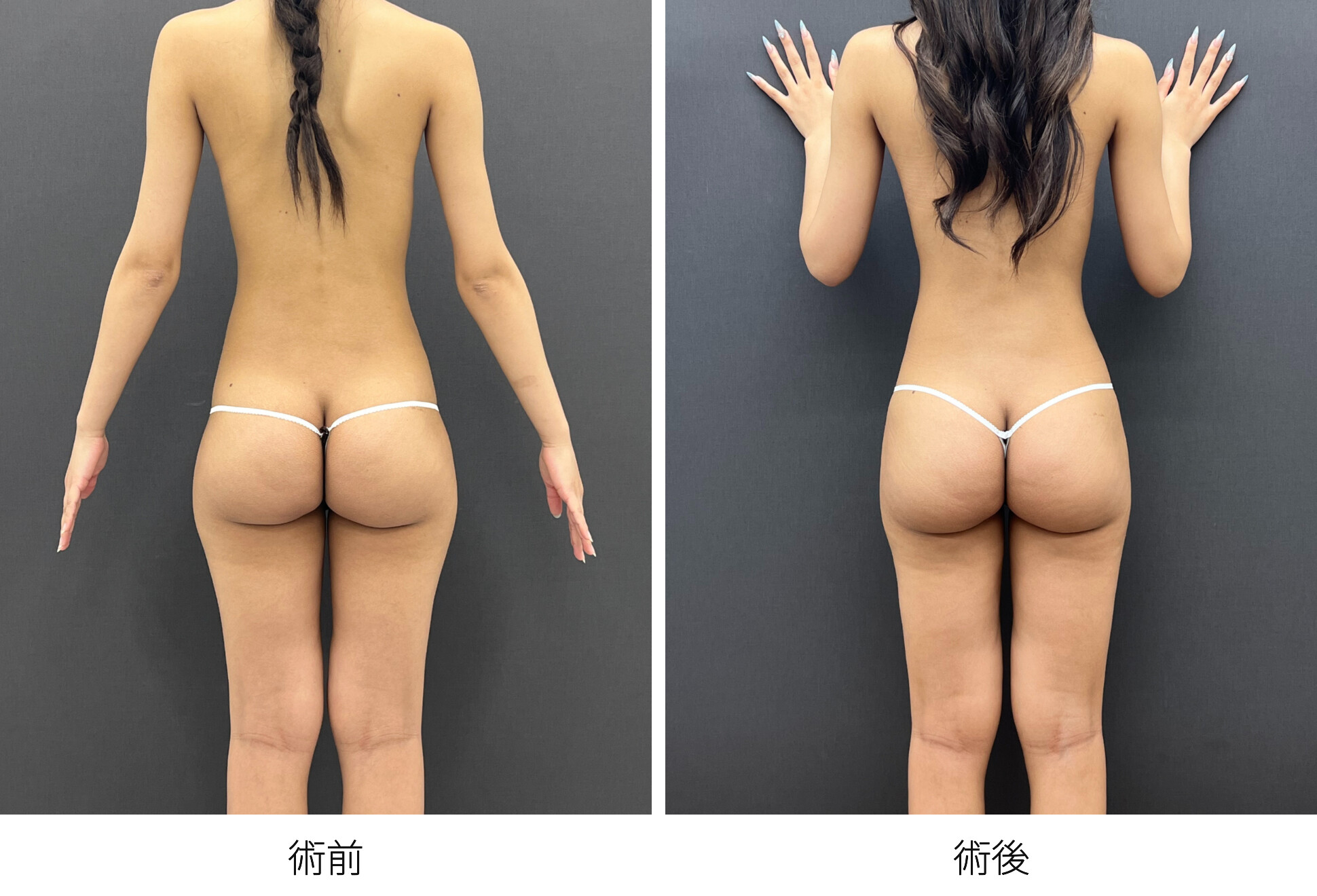 HIP DIPS（ヒップディップス） 脚長